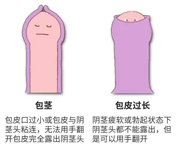 南山医院包皮手术优惠活动及知识科普